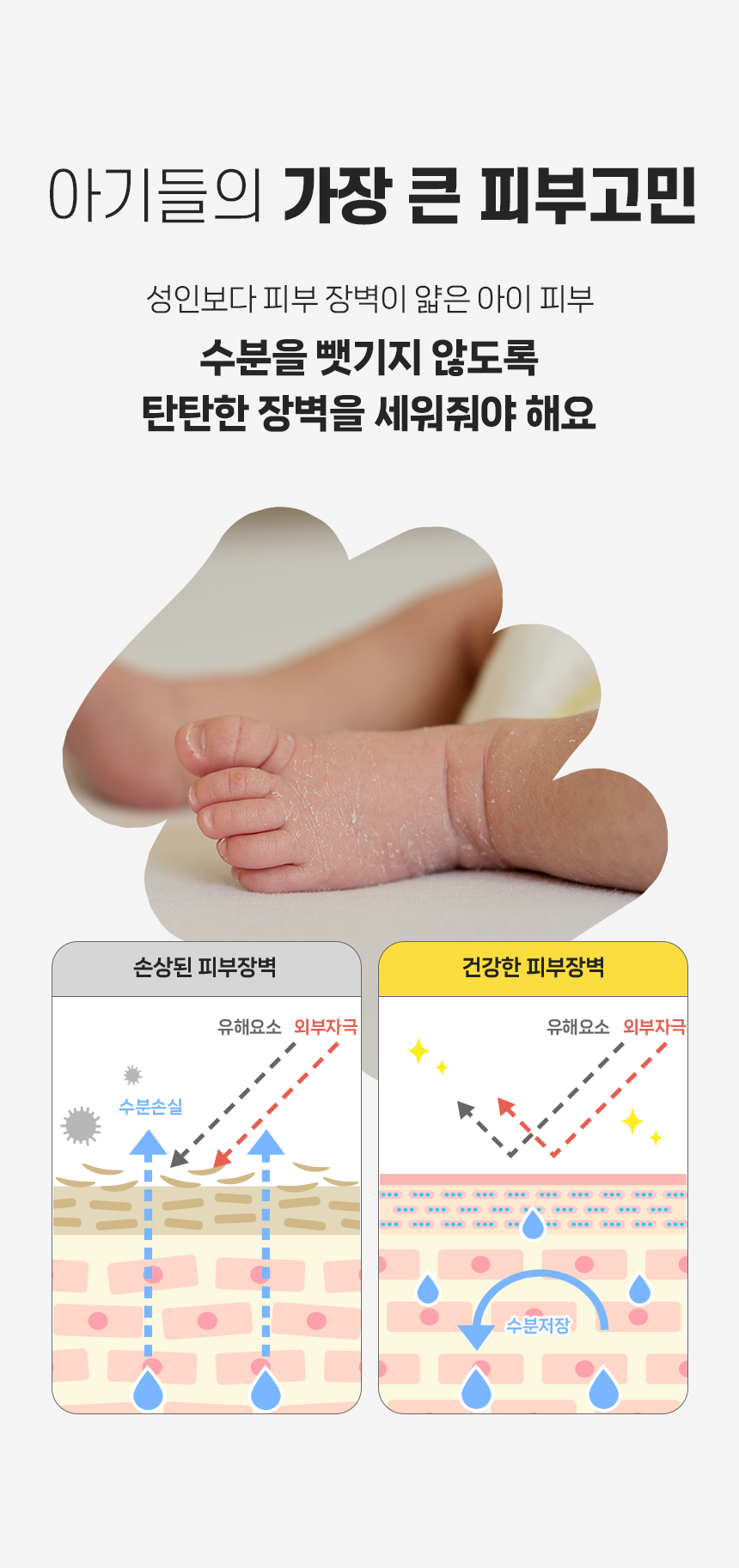 260320_앙또 베리어엠 로션_리뉴얼
