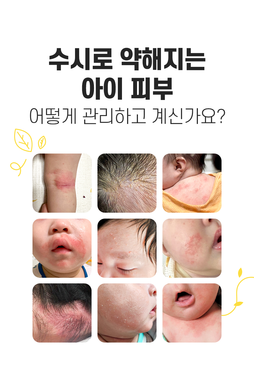 260320_앙또 베리어엠 로션_리뉴얼