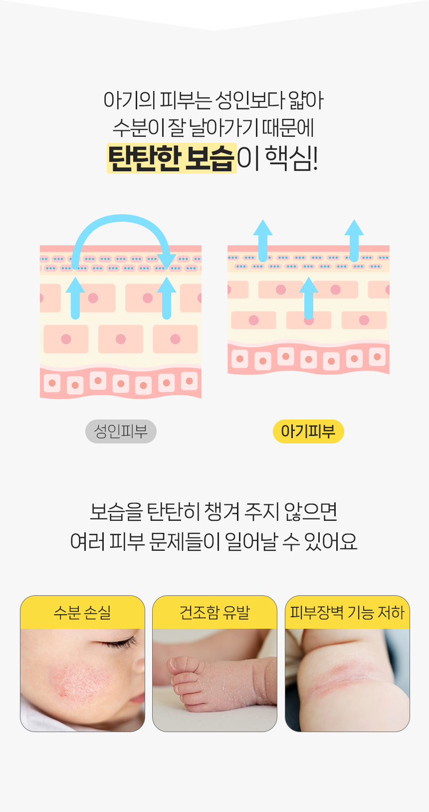 260320_앙또 베리어엠 로션_리뉴얼