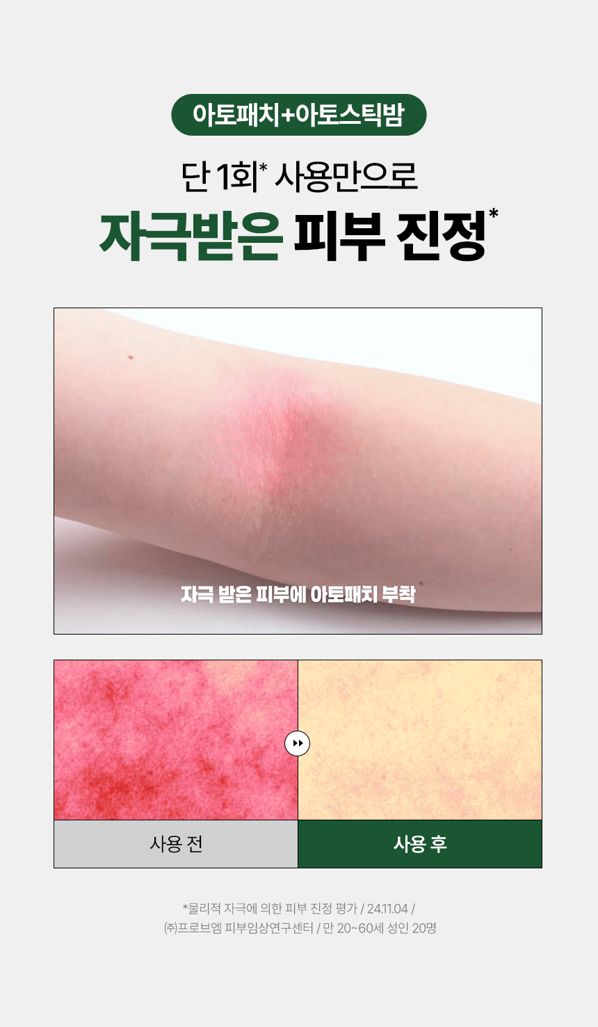 피부장벽 개선
