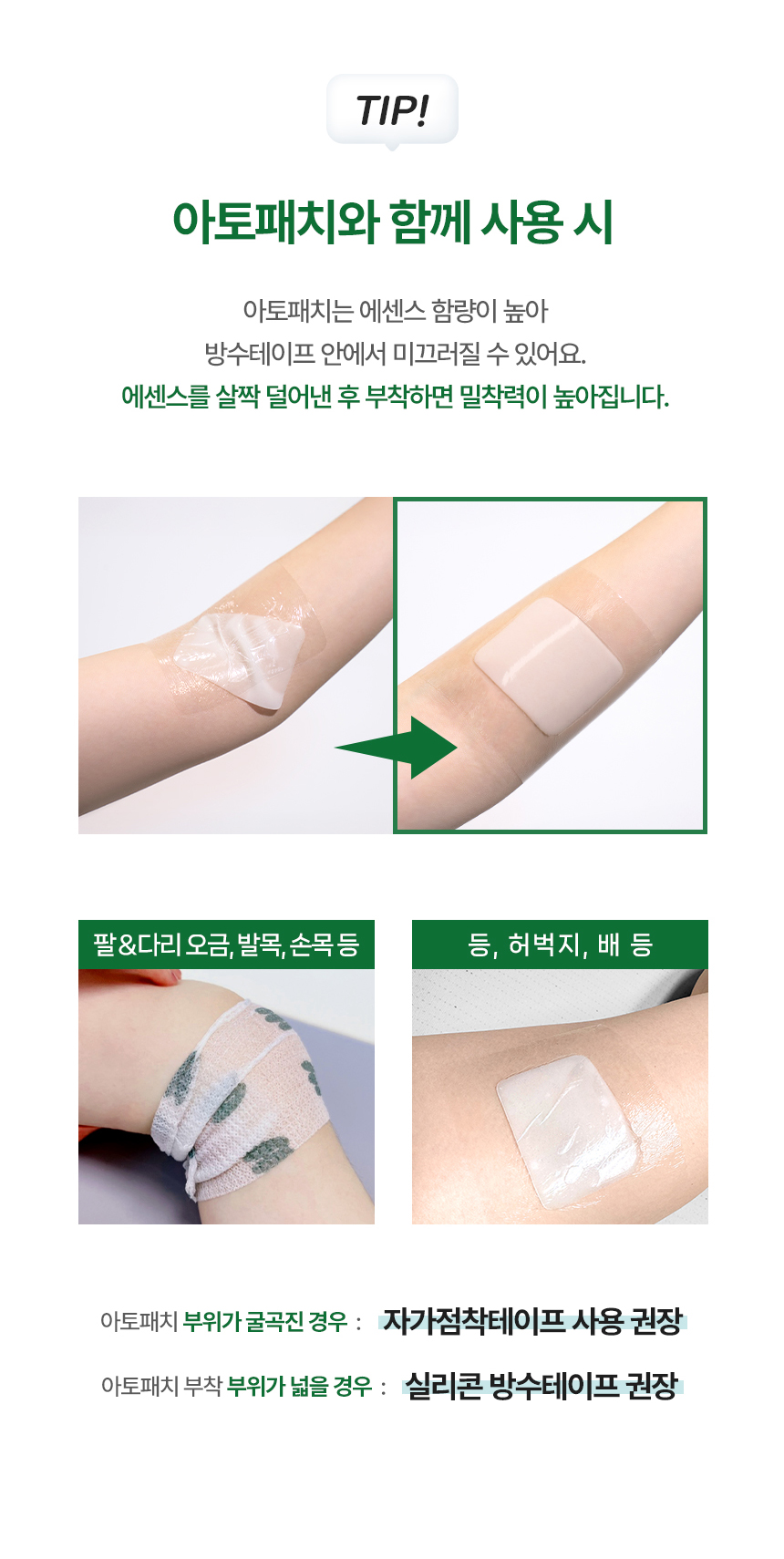 앙또 실리콘테이프