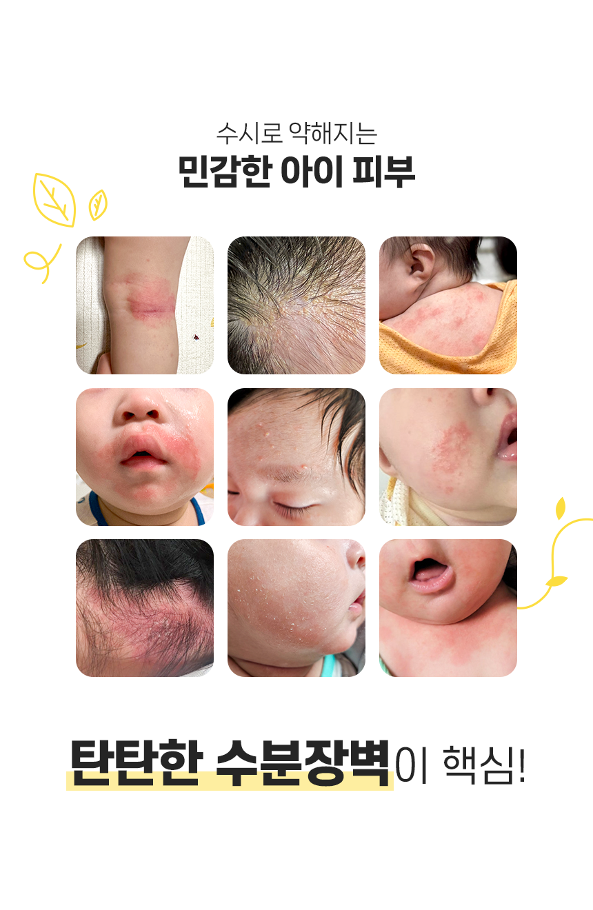 앙또 베리어엠 수딩젤